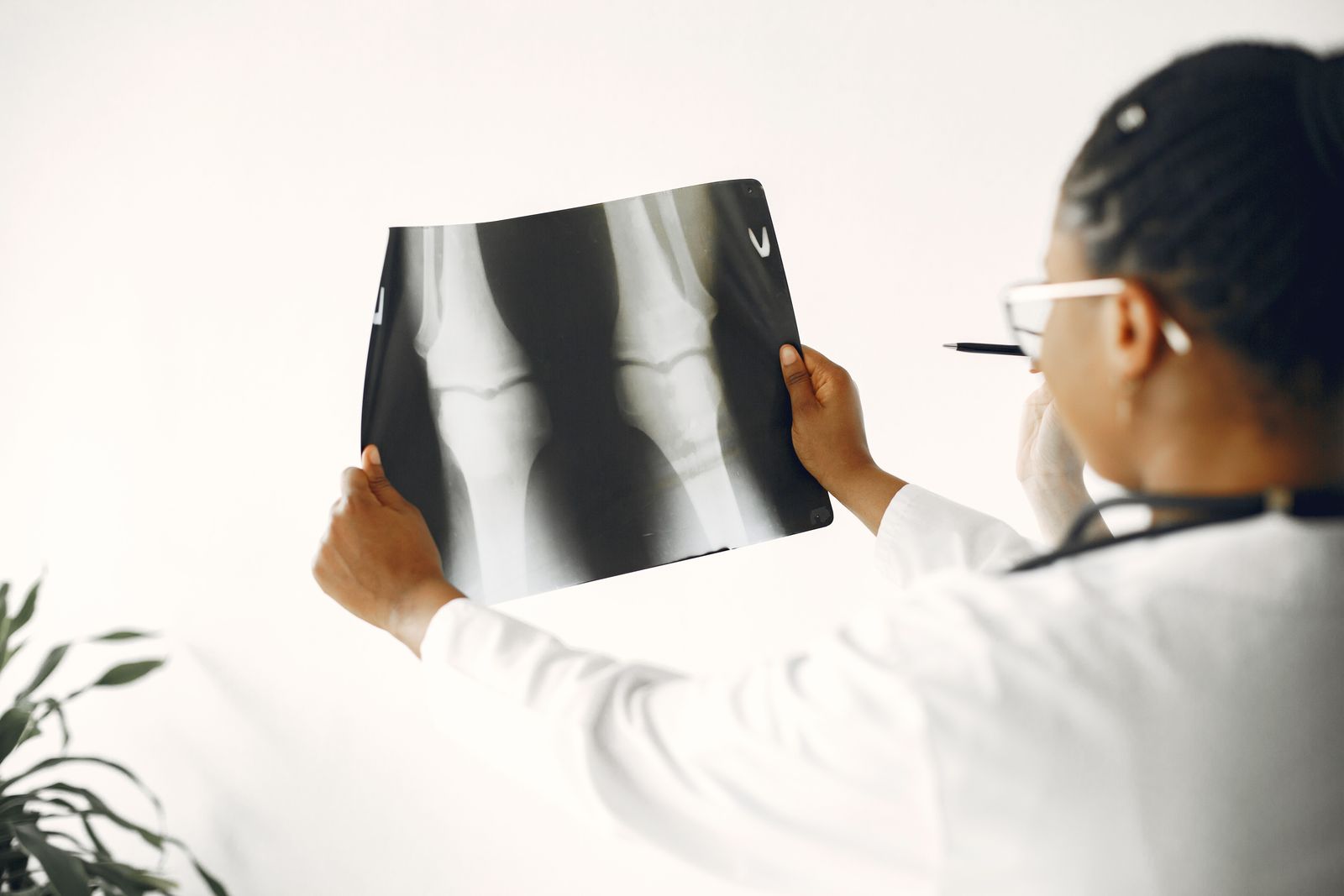 Orthopedic doctor reviewing a knee X-ray in the clinic